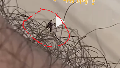 樂一樂|防蚊小妙招，長腿毛竟成為“防蚊神器”！-東方漢諾-北京快訊